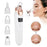 Electric Blackhead Remover - Vacuum Suction Facial Cleaner and Skin Care Extractor Tool for Blackheads, Pores, and Acne