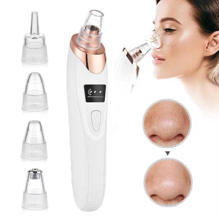 Electric Blackhead Remover - Vacuum Suction Facial Cleaner and Skin Care Extractor Tool for Blackheads, Pores, and Acne