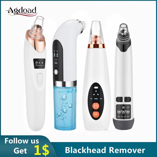 Electric Blackhead Remover - Vacuum Suction Facial Cleaner and Skin Care Extractor Tool for Blackheads, Pores, and Acne